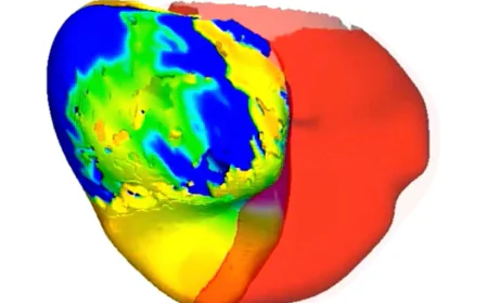 To fix a patient's irregular heartbeat, doctors first tested its digital 'twin'